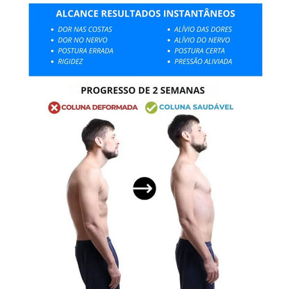 Estirador para Espalda - FlexiBack