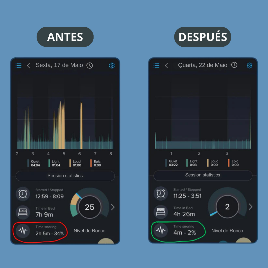 SilentFix® Solución Instantánea Anti-ronquidos