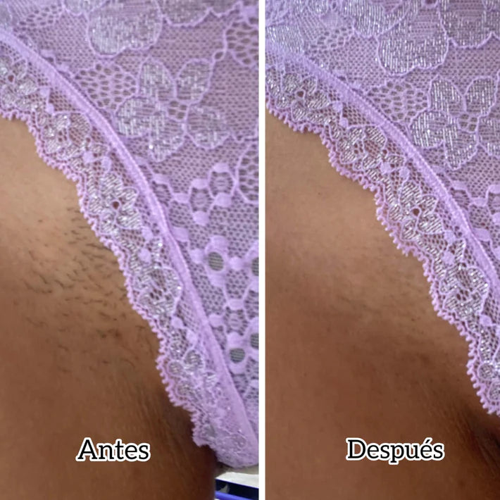 Depiladora Healovia®